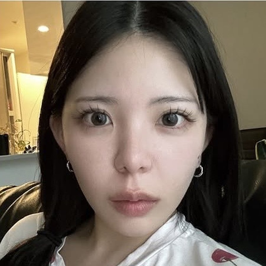 실리프팅 수술 후