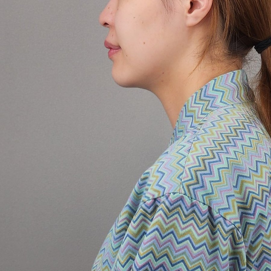 실리프팅 (민트 16줄) · 시술 직후 수술 전